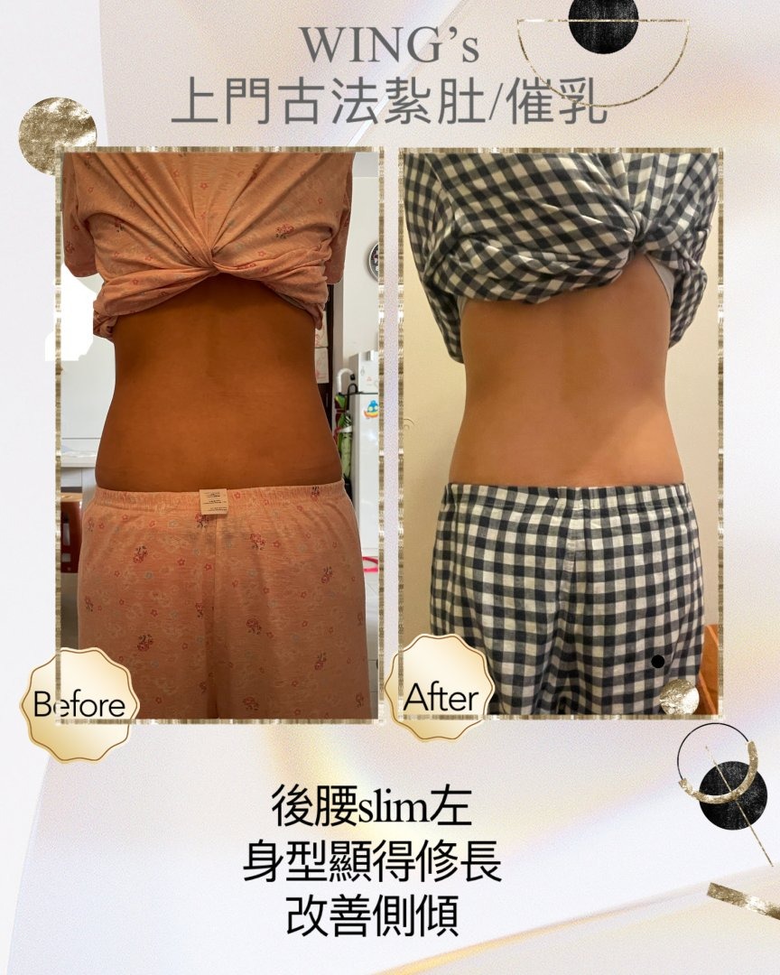 Wing's 護理相片 2