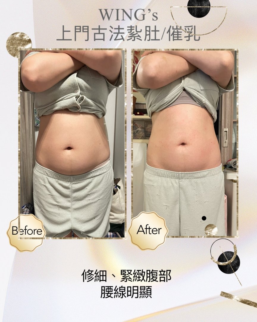 Wing's 護理相片 3