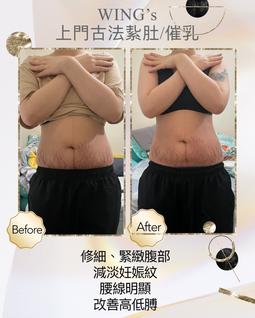 Wing's 護理相片 6