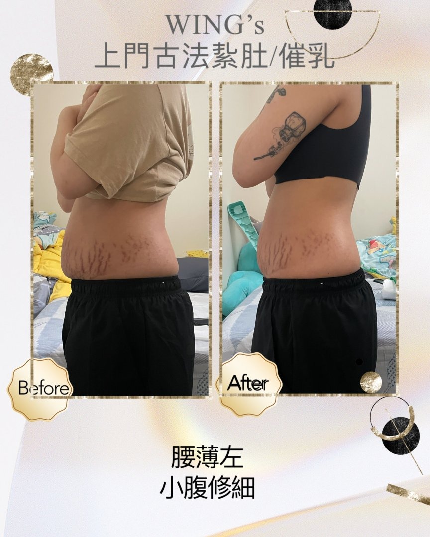 Wing's 護理相片 7