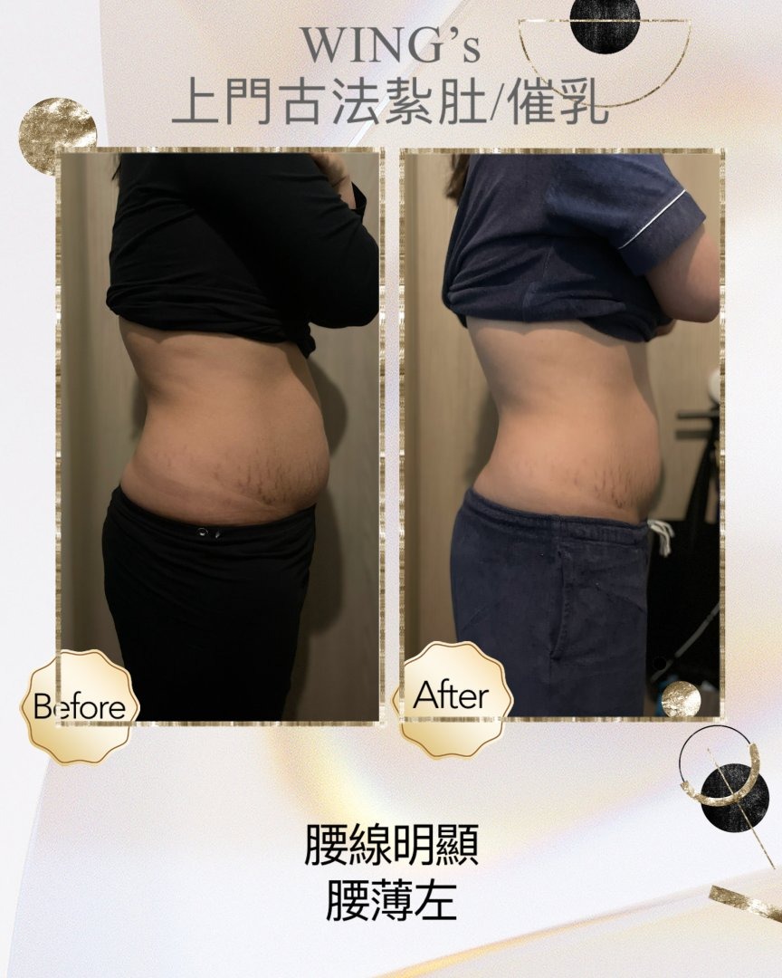 Wing's 護理相片 10