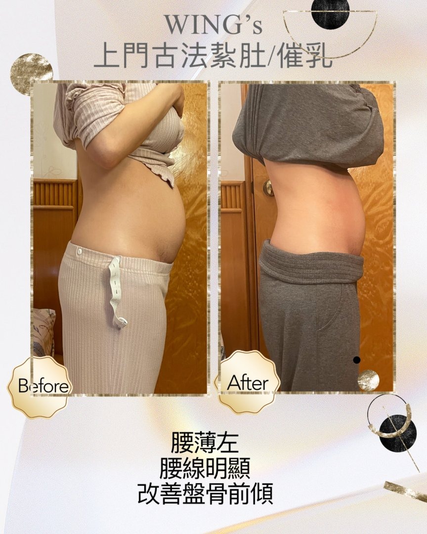 Wing's 護理相片 16