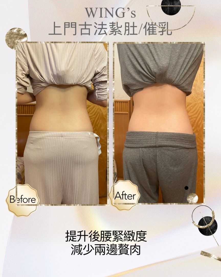 Wing's 護理相片 17