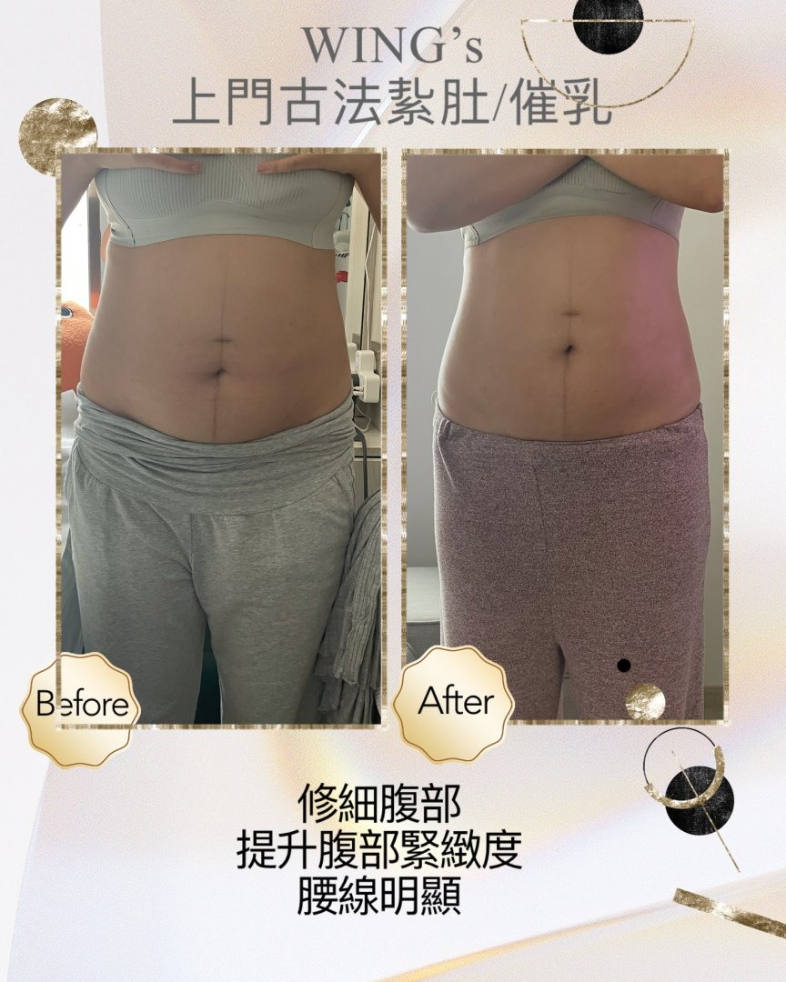 Wing's 護理相片 18