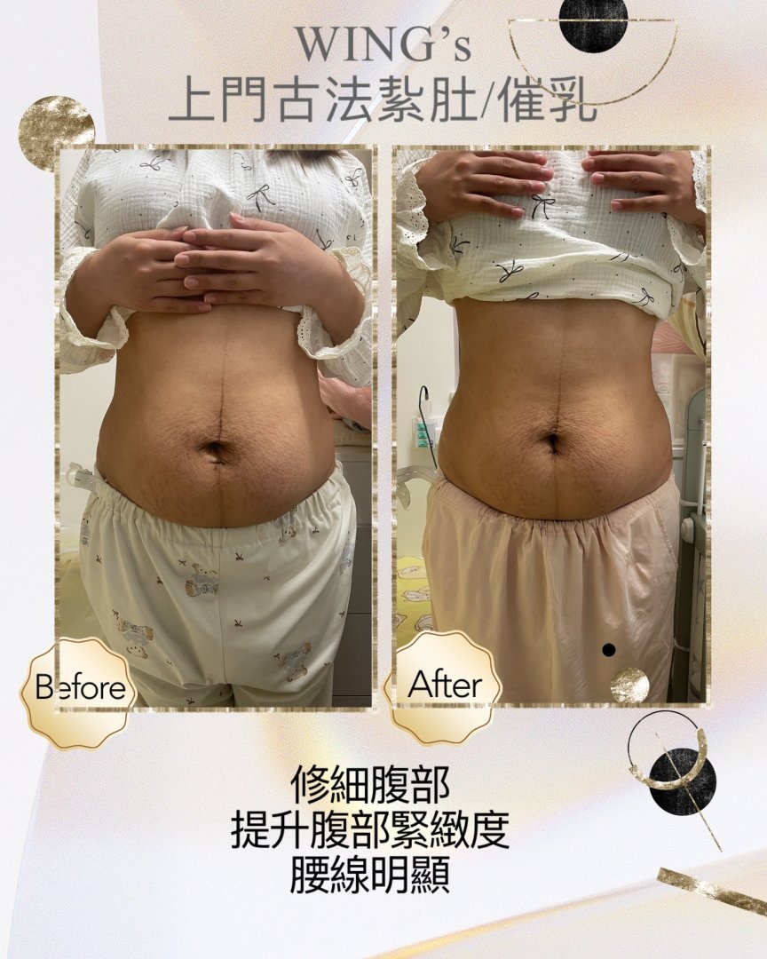 Wing's 護理相片 27