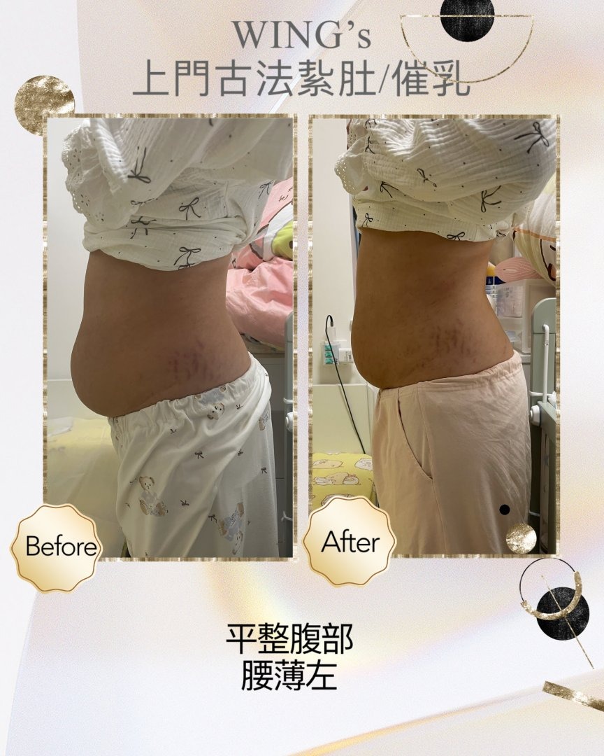 Wing's 護理相片 28