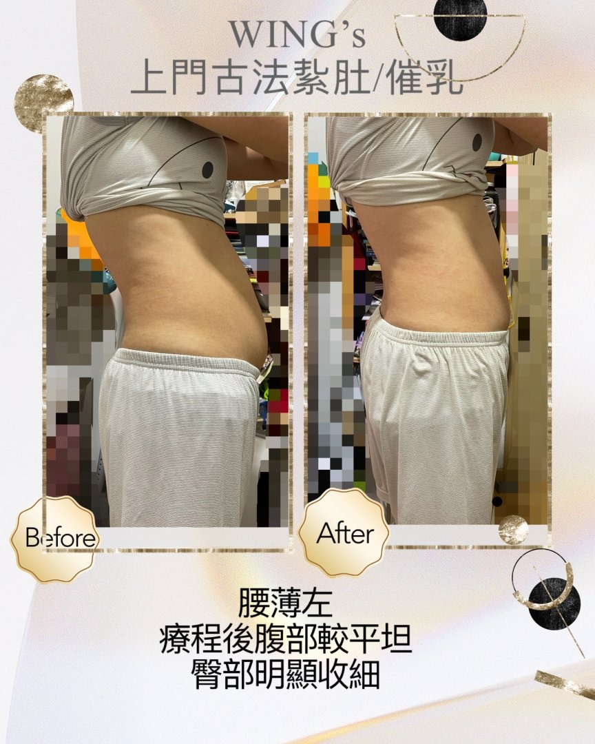 Wing's 護理相片 31