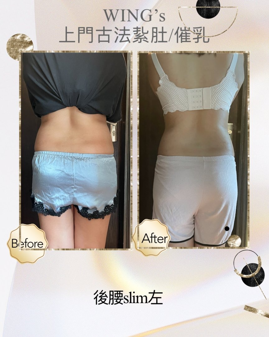 Wing's 護理相片 35