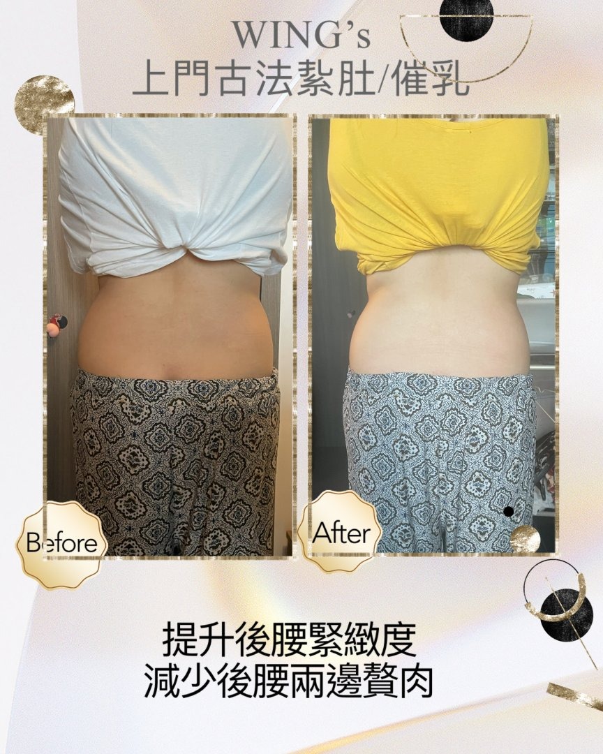 Wing's 護理相片 38