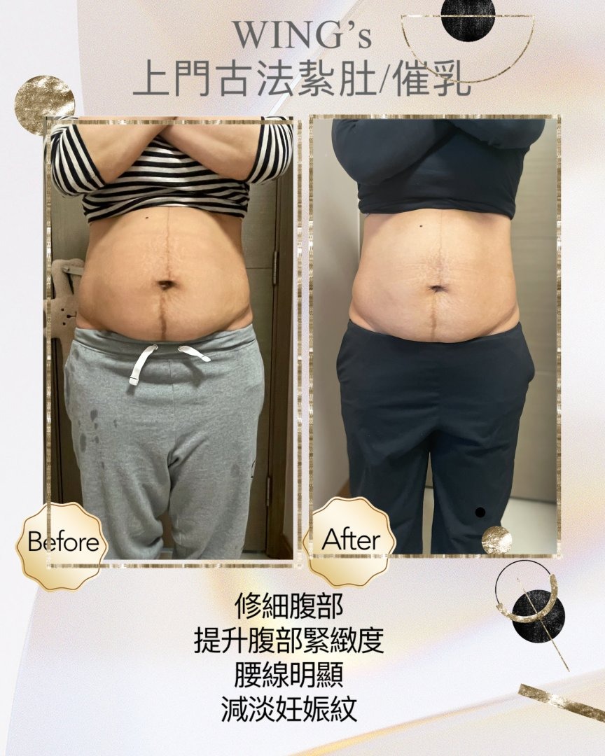 Wing's 護理相片 39