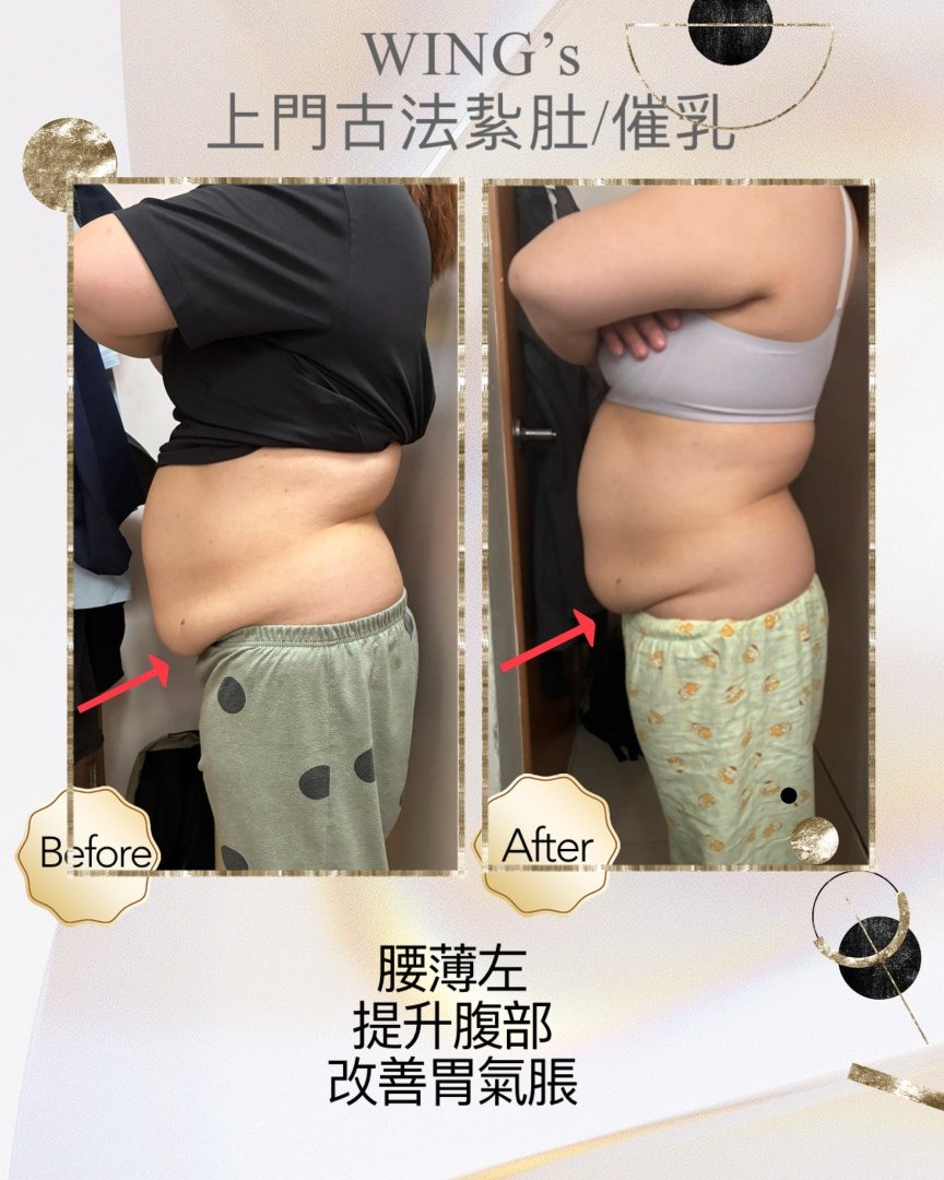 Wing's 護理相片 43